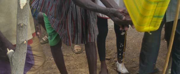 Le Tippy Tap, un dispositif simple de lavage de mains initié par la croix-rouge Burkinabè